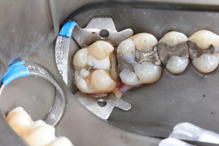 Frank Fukuda #15 prep