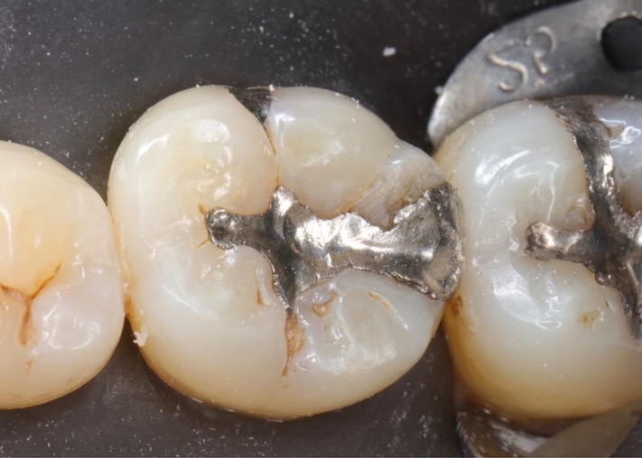 Frank Fukuda #19 pre-op