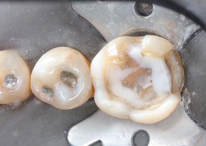 Frank Fukuda #19 prep