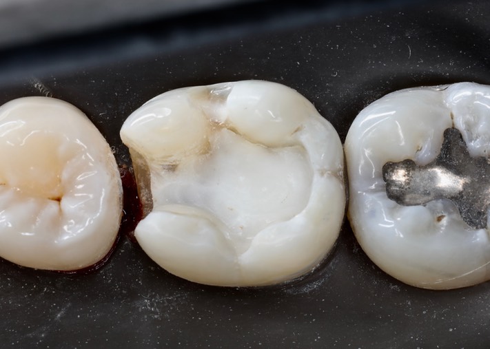 Frank Fukuda #19 prep