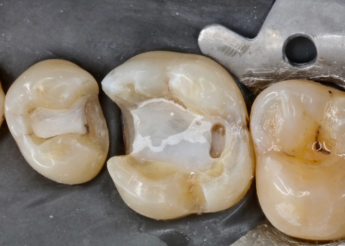 Frank Fukuda #3-4 prep