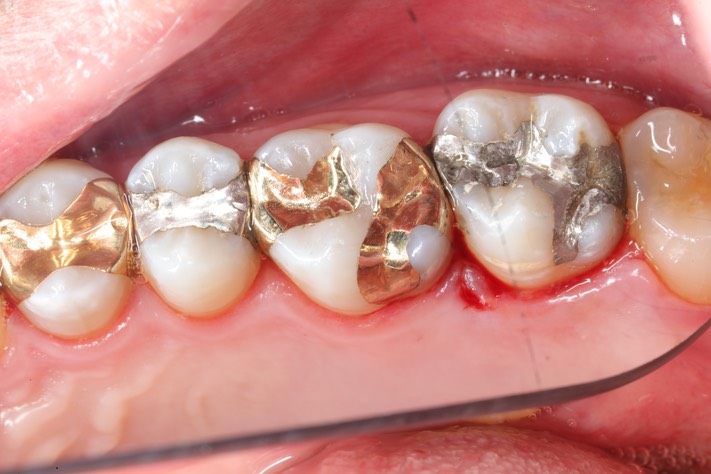 Frank Fukuda #3 finish