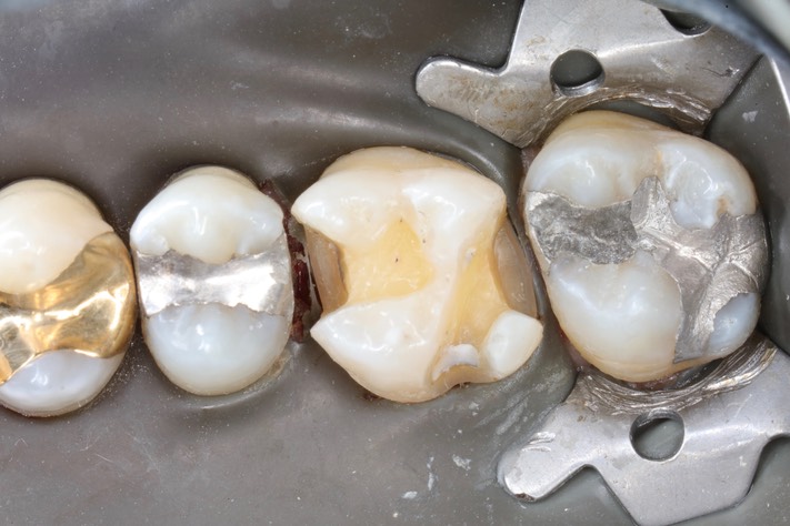 Frank Fukuda #3 prep