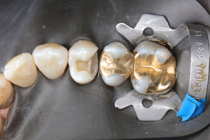 Frank Fukuda #5 prep