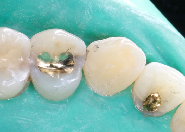 Gary Umeda #10 & 12 finish