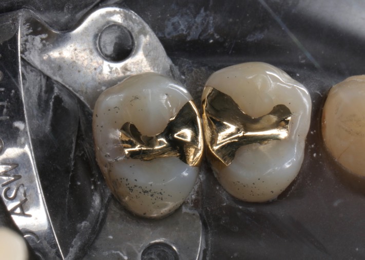 Gary Umeda #12-13 finish – 