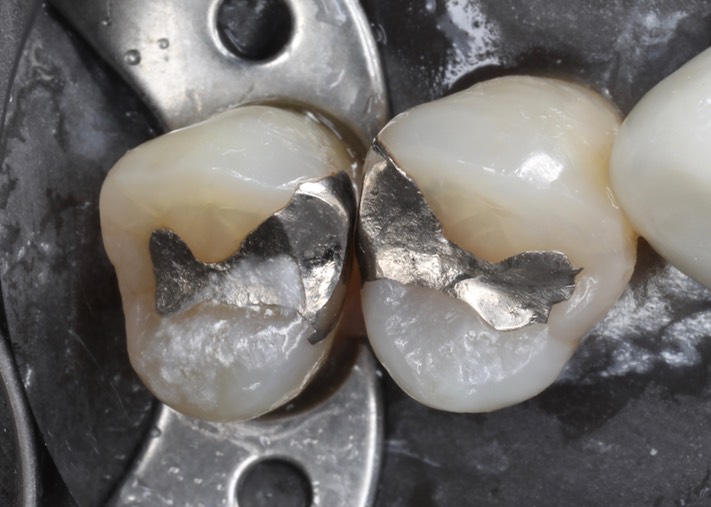 Gary Umeda #12-13 pre-op