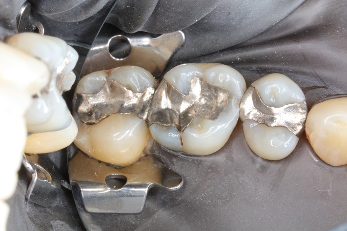 Gary Umeda #13-14 pre-op