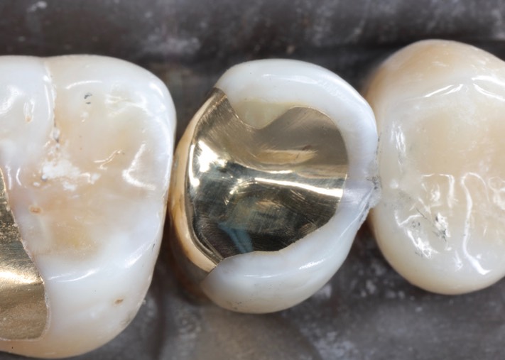 Gary Umeda #13 finish