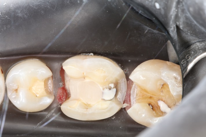 Gary Umeda #18, 19, 20 prep