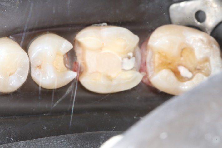 Gary Umeda #18, 19, 20 prep