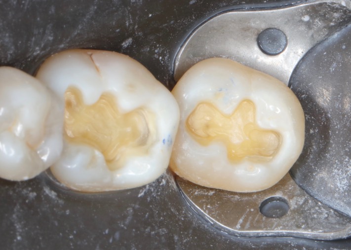 Gary Umeda #18-19 prep