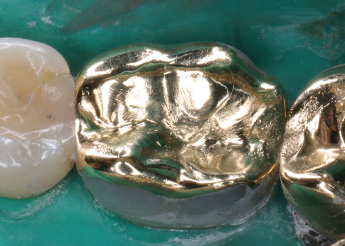 Gary Umeda #19 finish