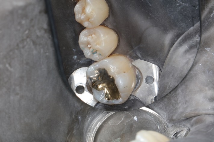 Gary Umeda #19 finish