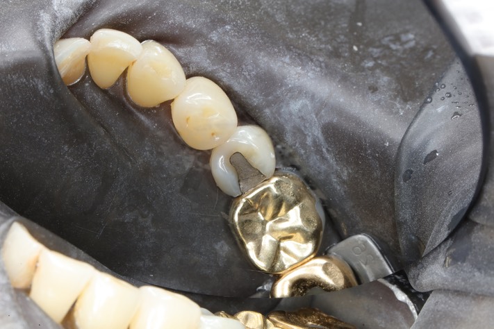 Gary Umeda #20 pre-op