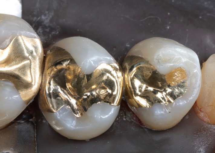 Gary Umeda #28-29 finish