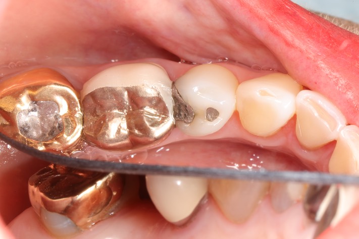 Gary Umeda #28 pre-op