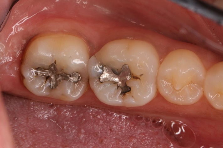 Gary Umeda #30-31 pre-op