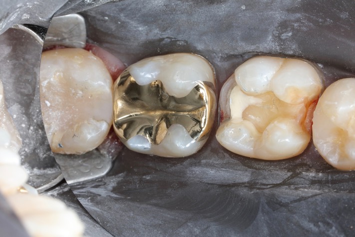 Gary Umeda #31 finish