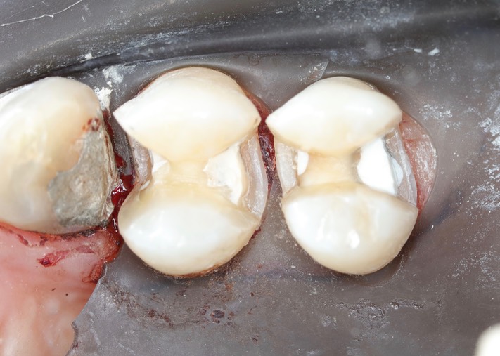 Gary Umeda #4-5 prep