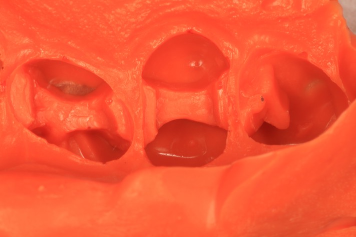 Gary Umeda #4,5,6 impression