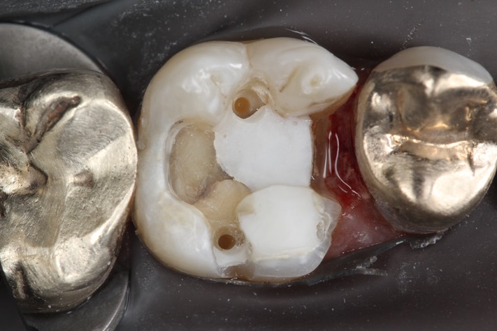 Larry Fujioka #14 prep