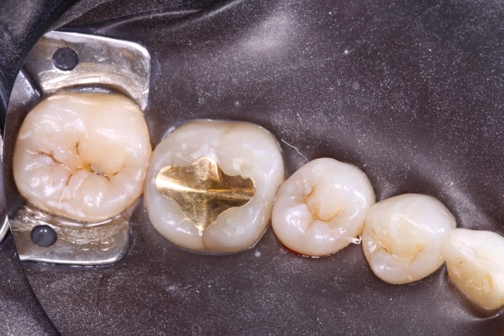 Mason Savage #31 pre-op