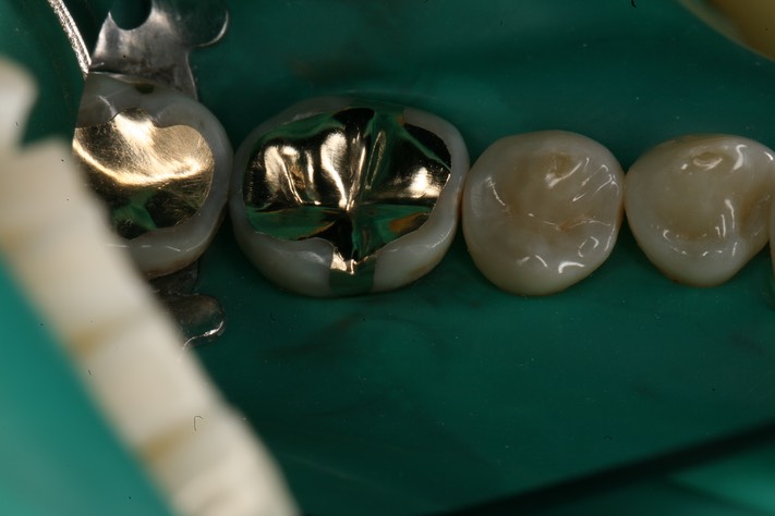 Bryan Sato #30 finish - lingual