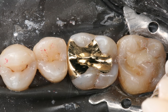 Kyle Chock #3 finish