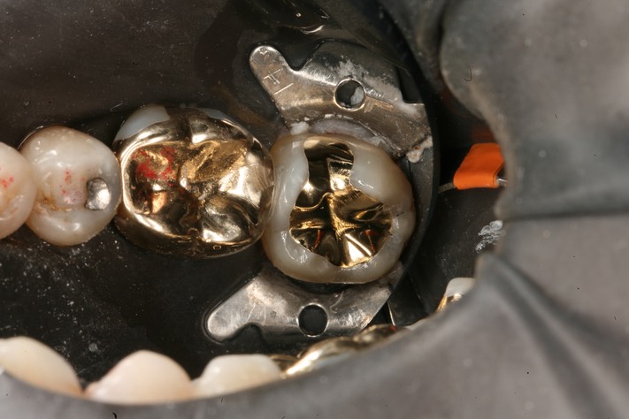 Alan Chinn #18 finish