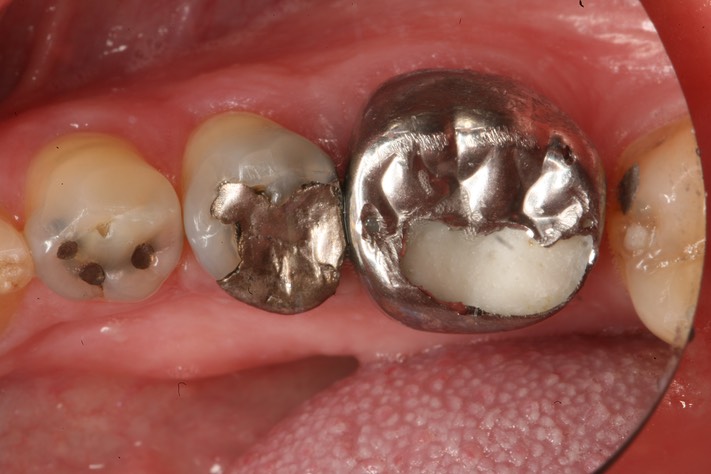 Gary Umeda #19-20 pre-op