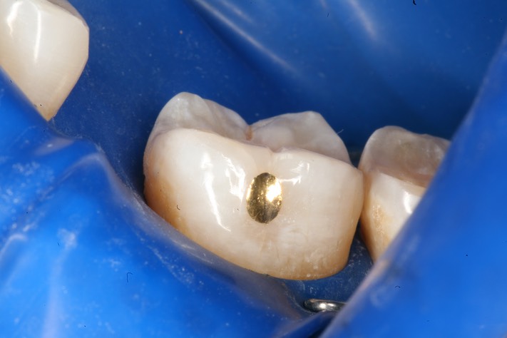 Mark Chun #18 finish