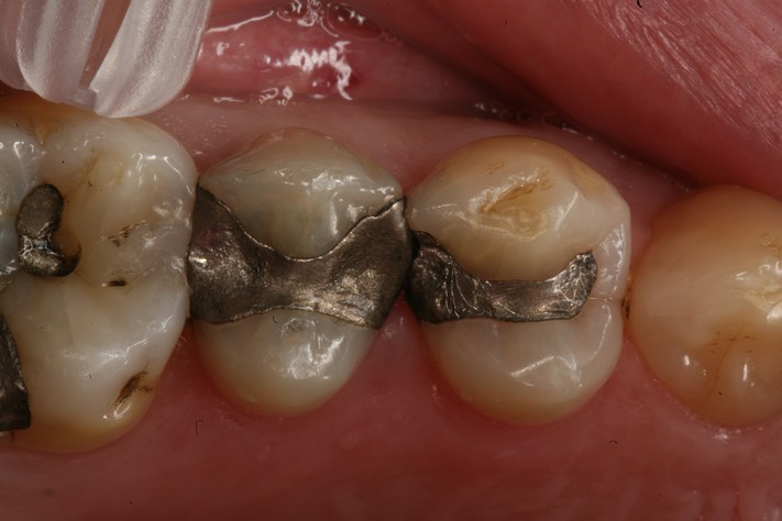 Brian Sato #12-13 pre-op