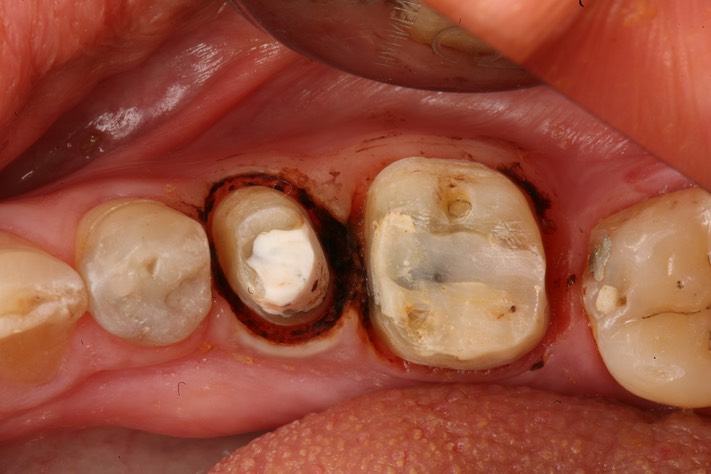 Gary Umeda #19-20 prep