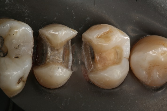 Brian Sato #12-13 prep