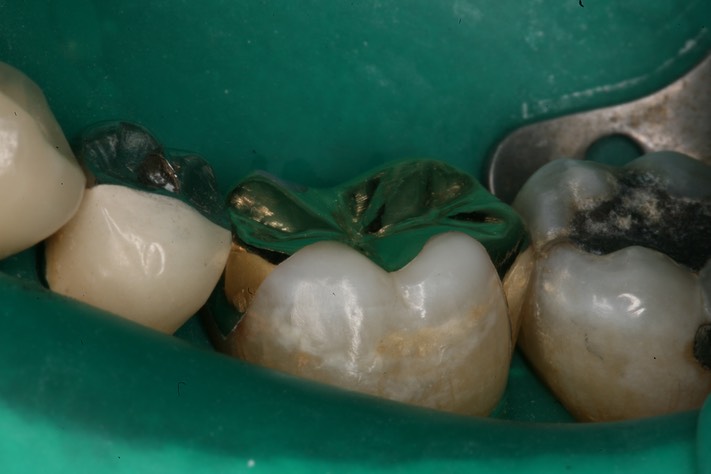 Scott Kanamori finish