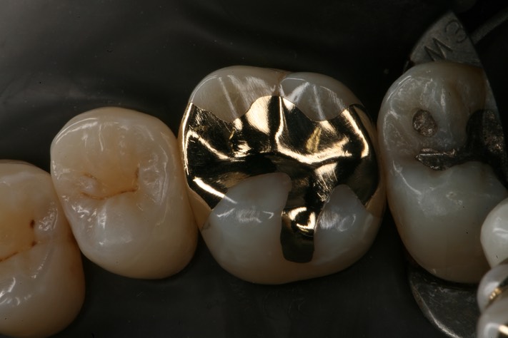 Larry Fujioka finish