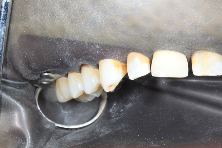 Larry Fujioka #6 pre-op