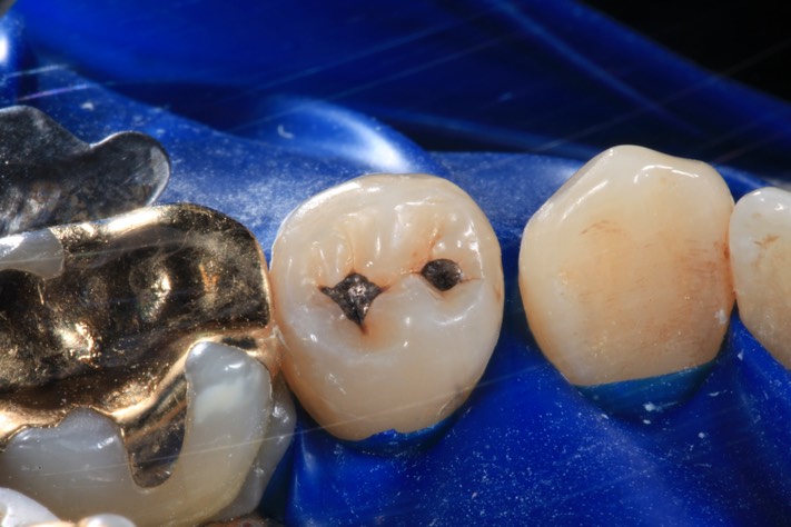 Mark Chun #29 pre-op