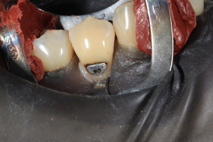 Gary Umeda #28 pre-op