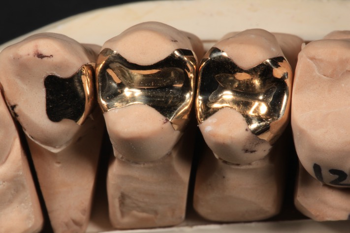 Gary Umeda #12,12,13 castings