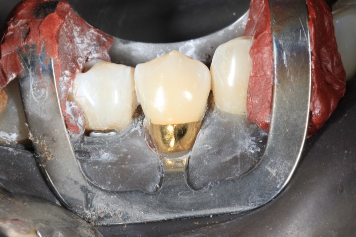 Gary Umeda #28 finish