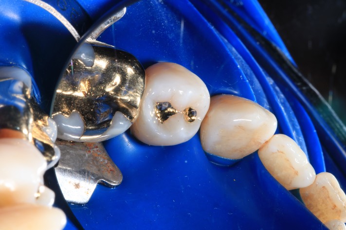 Mark Chun #28 finish