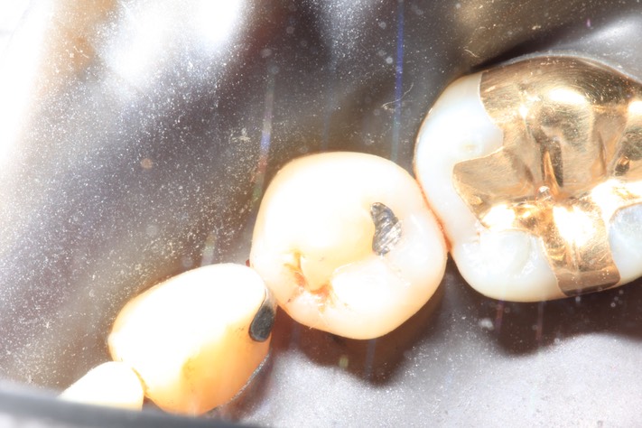 Brian Sato #20 pre-op