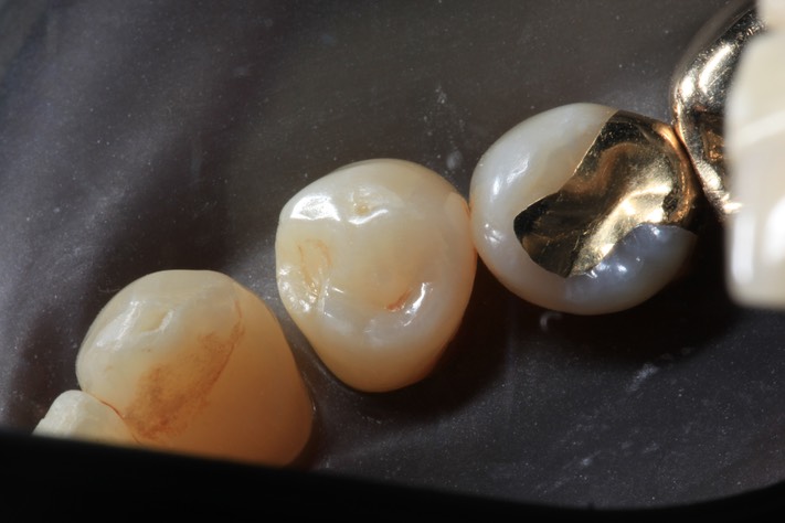 Russ Tabata #21 pre-op