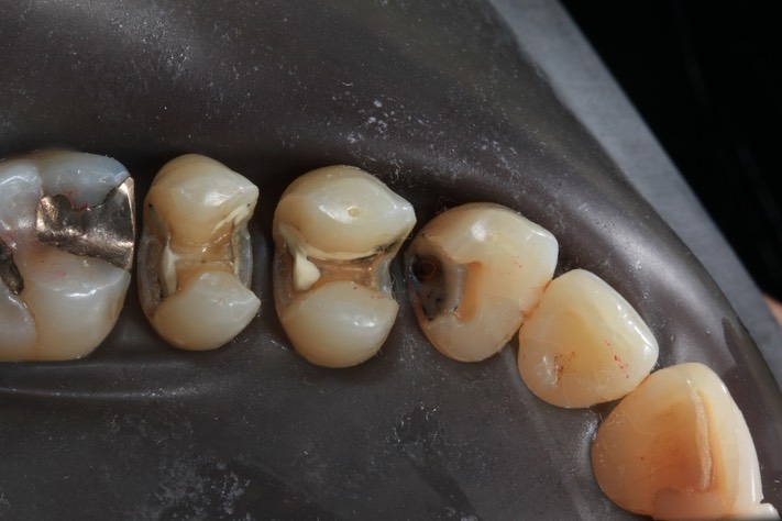 Gary Umeda #11,12,13 prep