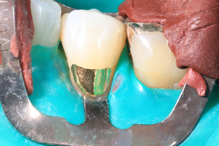 Ted Kanamori #20 finish