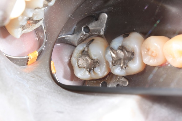 Bryan Sato #31 pre-op