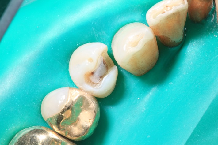 Scott Kanamori @28 prep