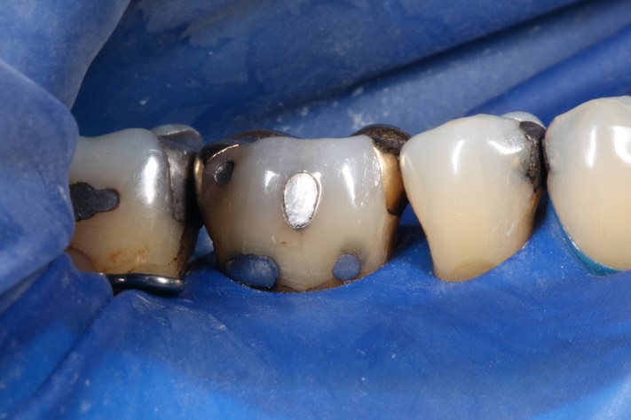 Mark Chun #30 pre-op